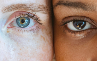 Tear Trough Filler Complications: A Guide to Risks & Solutions