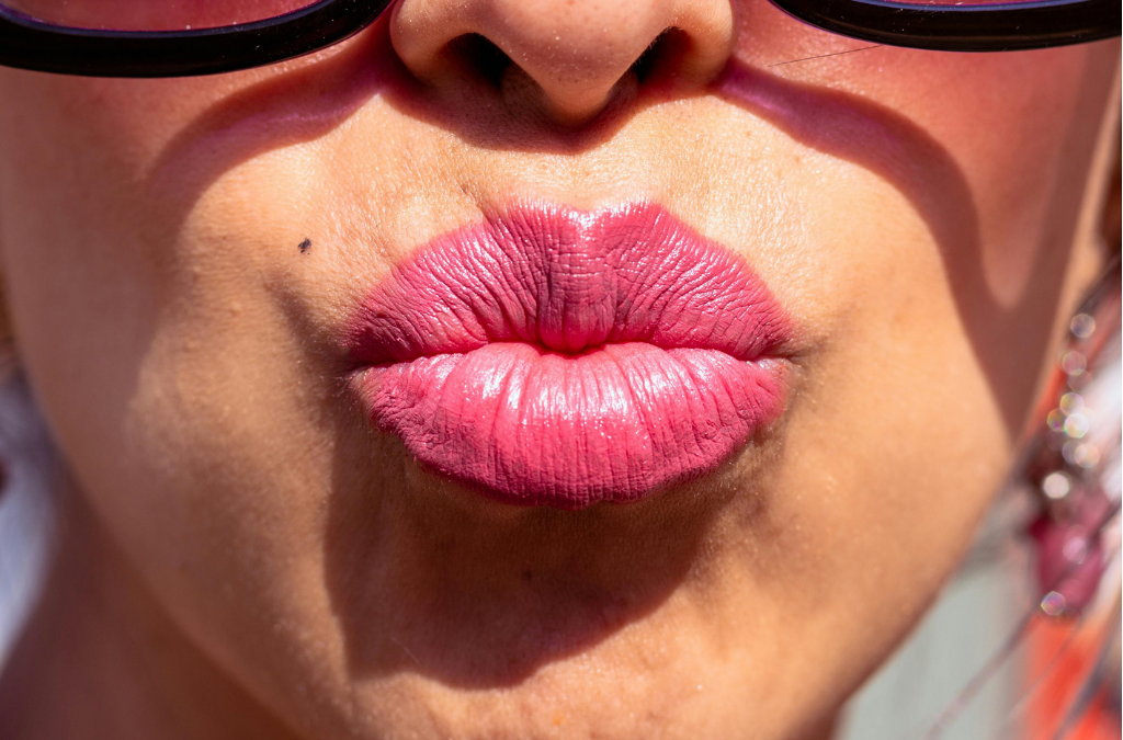 Why Polynucleotides for Lips are Redefining Modern Lip Treatments